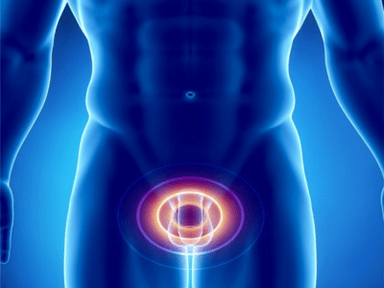 Prostatita – inflamație a prostatei la bărbați